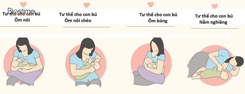 viêm tuyến sữa