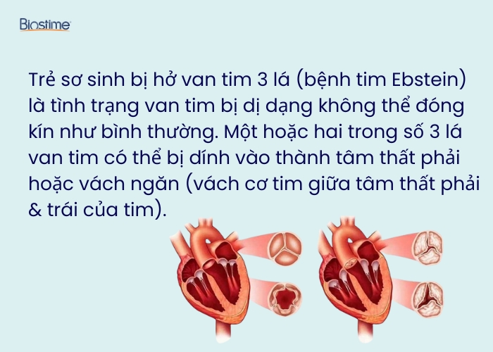 Trẻ sơ sinh bị hở van tim