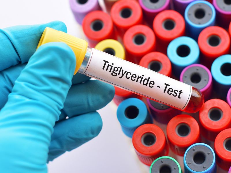 Giải đáp: Lượng cholesterol trong máu bao nhiêu là bình thường? 9 Xét nghiệm lipid máu giúp xác định chính xác các chỉ số cholesterol, đánh giá nguy cơ tim mạch và định hướng điều trị kịp thời