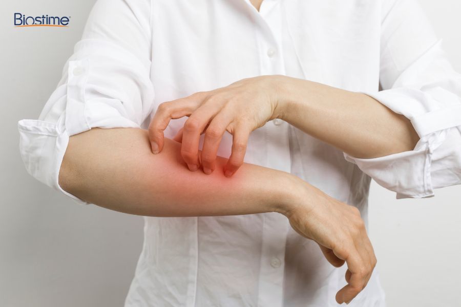 Công dụng của rau mùi đối với sức khỏe và cách sử dụng hiệu quả 9 Nếu bị dị ứng với rau mùi, cần tránh ăn hoặc tham khảo ý kiến bác sĩ