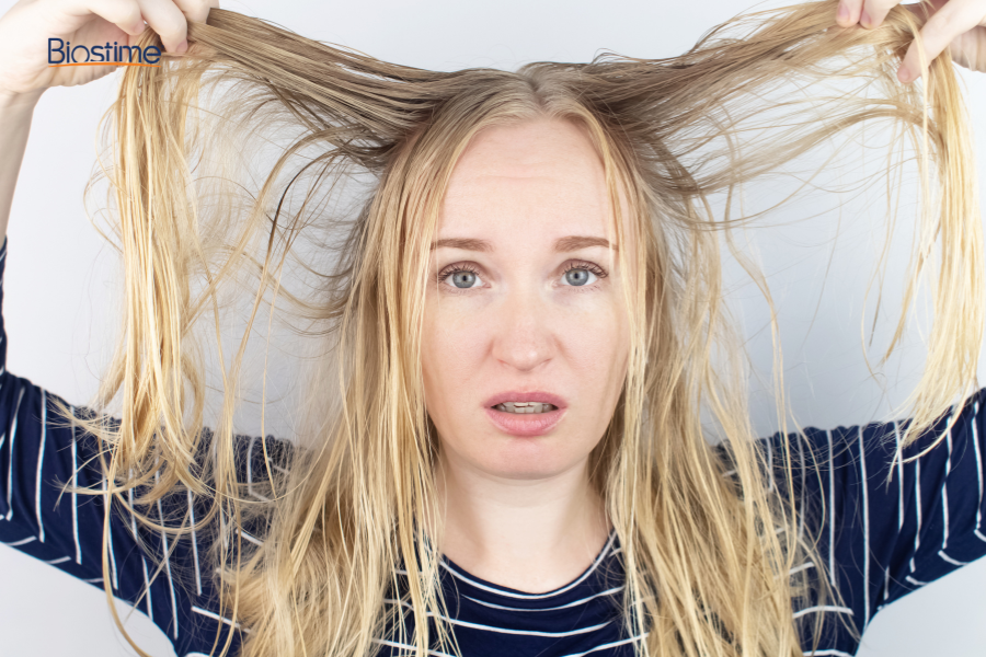 Giải đáp chi tiết: Dùng dầu dừa có kích thích mọc tóc không? 17 Người có da đầu dầu cần cân nhắc kỹ trước khi sử dụng