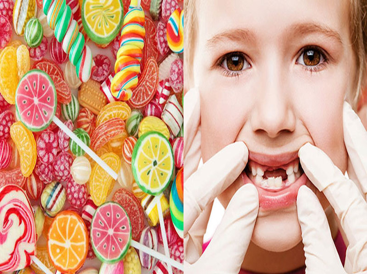 Trẻ bị sâu răng hàm: Nguyên nhân và cách điều trị hiệu quả 9 Hạn chế ăn đồ ngọt như bánh kẹo để bảo vệ sức khỏe răng miệng